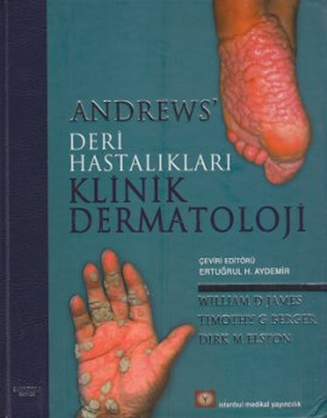 Andrews Deri Hastalıkları Klinik Dermatoloji.pdf