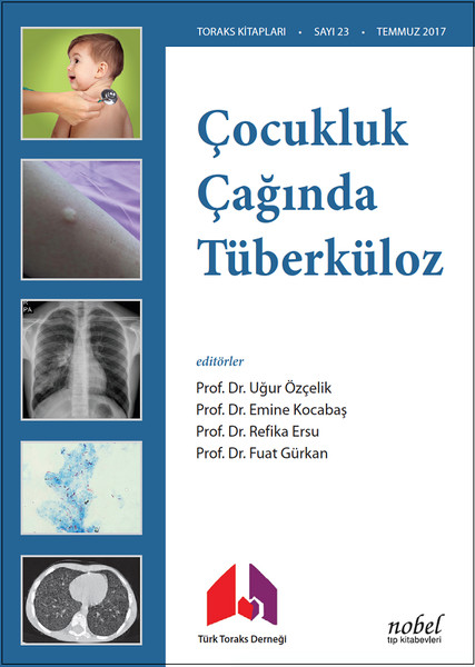 Çocukluk Çağında Tüberküloz.pdf