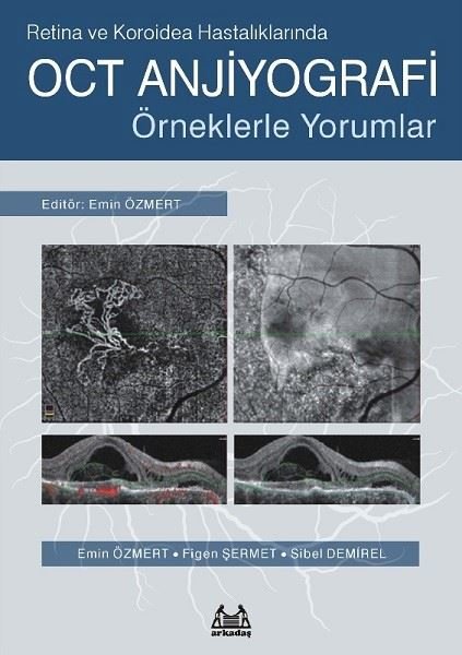 Retina ve Koroidea Hastalıklarında OCT Anjiyografi Örneklerle Yorumlar.pdf