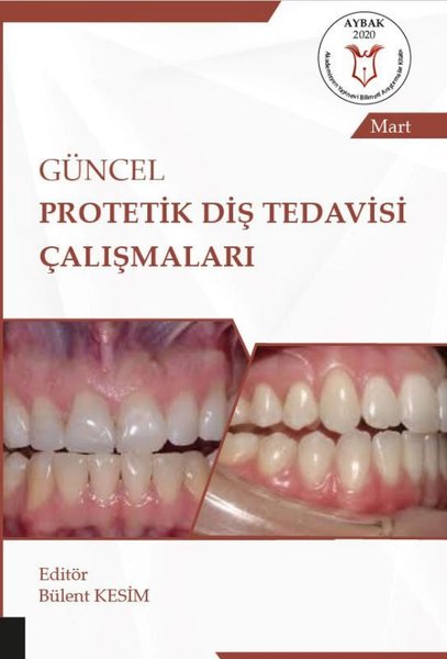 Güncel Protetik Diş Tedavisi Çalışmaları.pdf