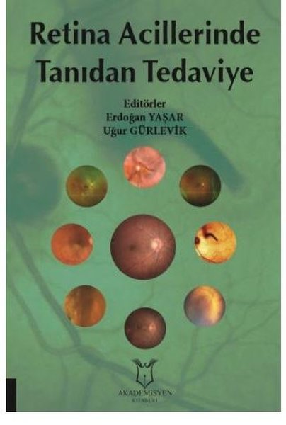 Retina Acillerinde Tanıdan Tedaviye.pdf