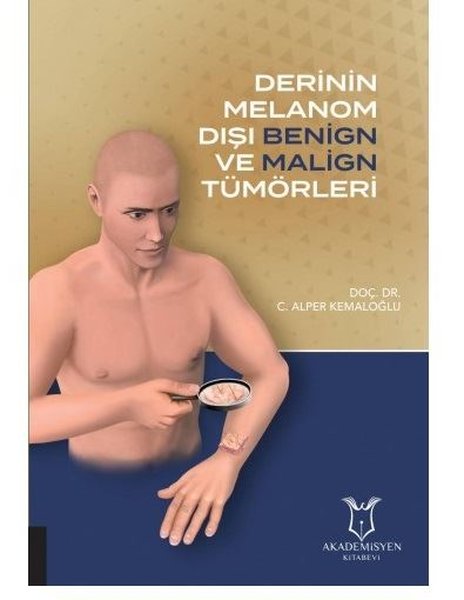 Derinin Melanom Dışı Benign ve Malign Tümörleri.pdf