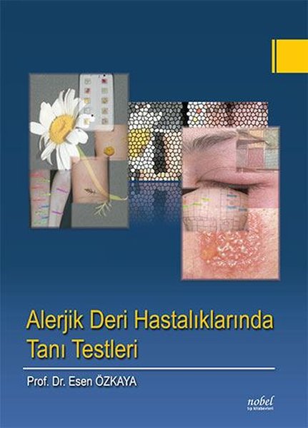 Alerjik Deri Hastalıklarında Tanı Testleri.pdf