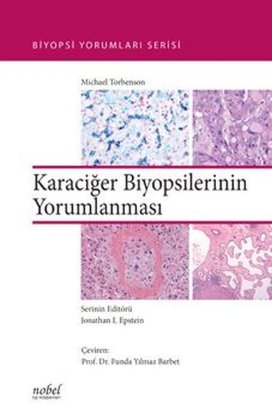 Biyopsilerin Yorumu: Karaciğer.pdf