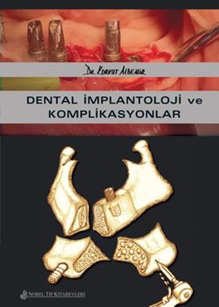 Dental İmplantoloji ve Komplikasyonlar.pdf