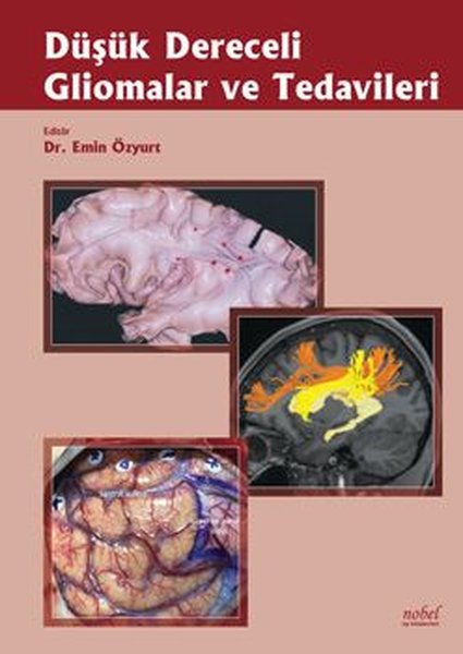 Düşük Dereceli Gliomalar Ve Tedavileri.pdf