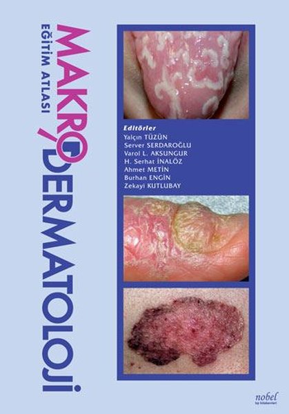 Makrodermatoloji Eğitim Atlası.pdf