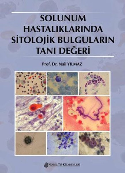 Solunum Hastalıklarında Sitolojik Bulguların Tanı Değeri.pdf
